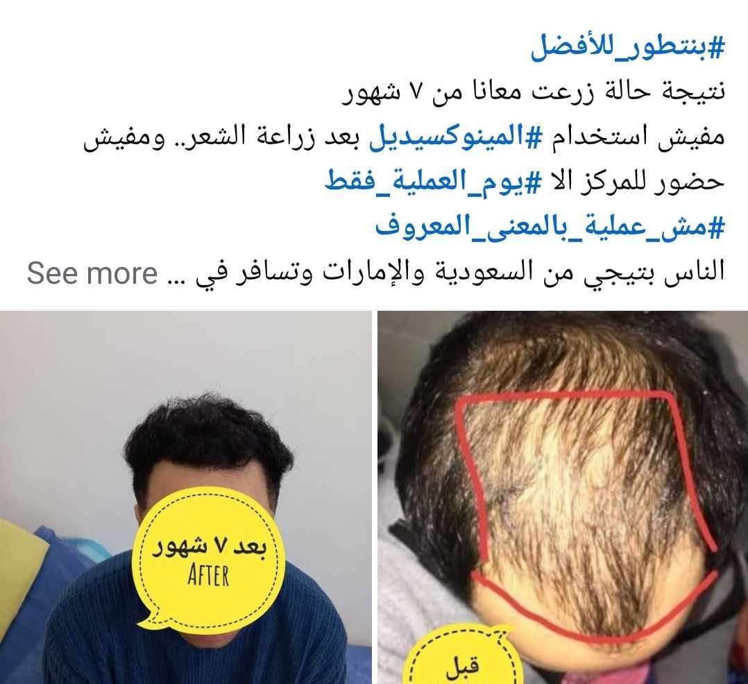 صورة عميل