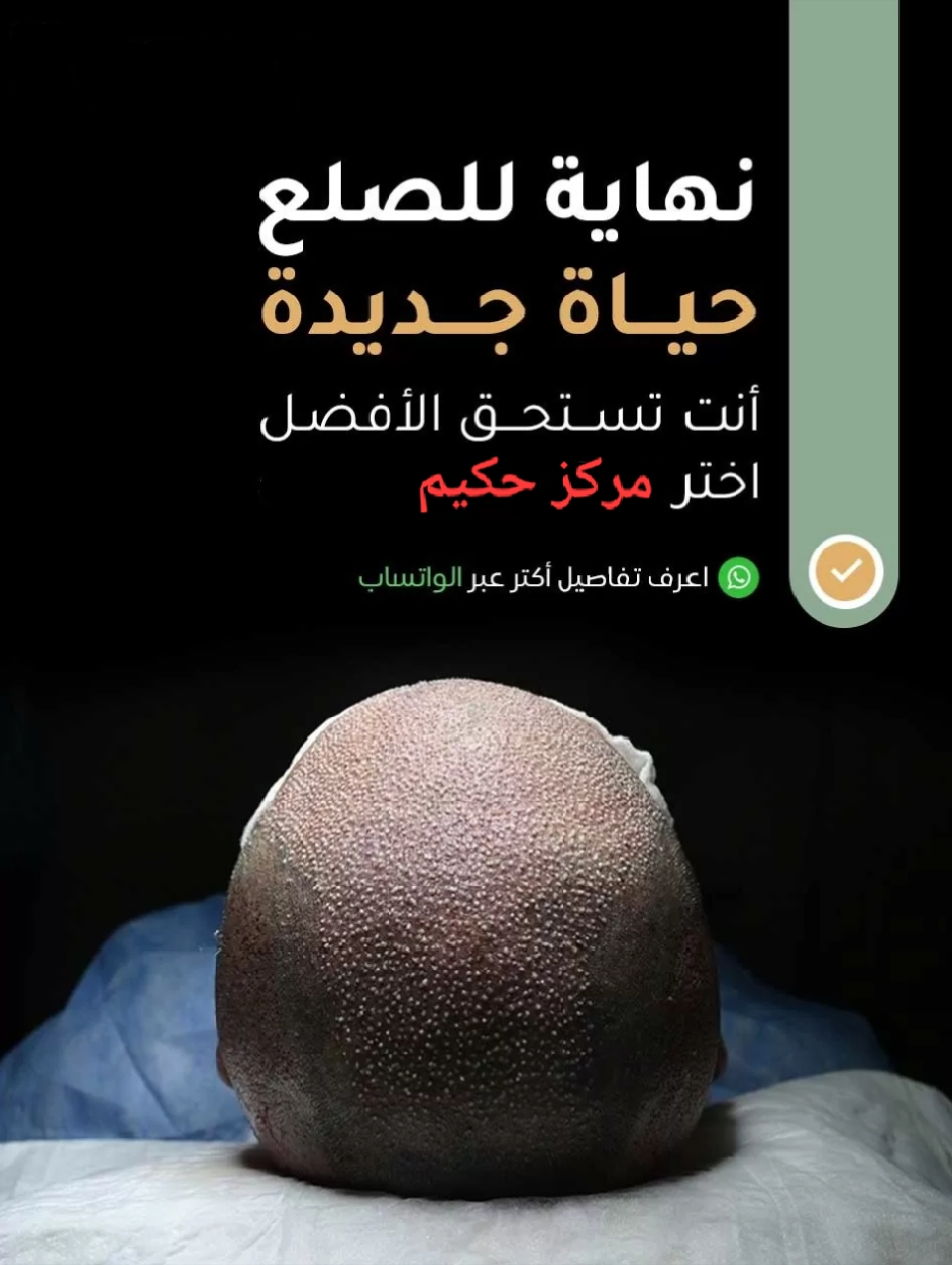 حجز موعد