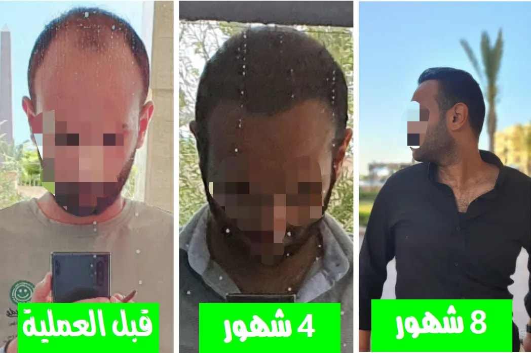 بعد 3