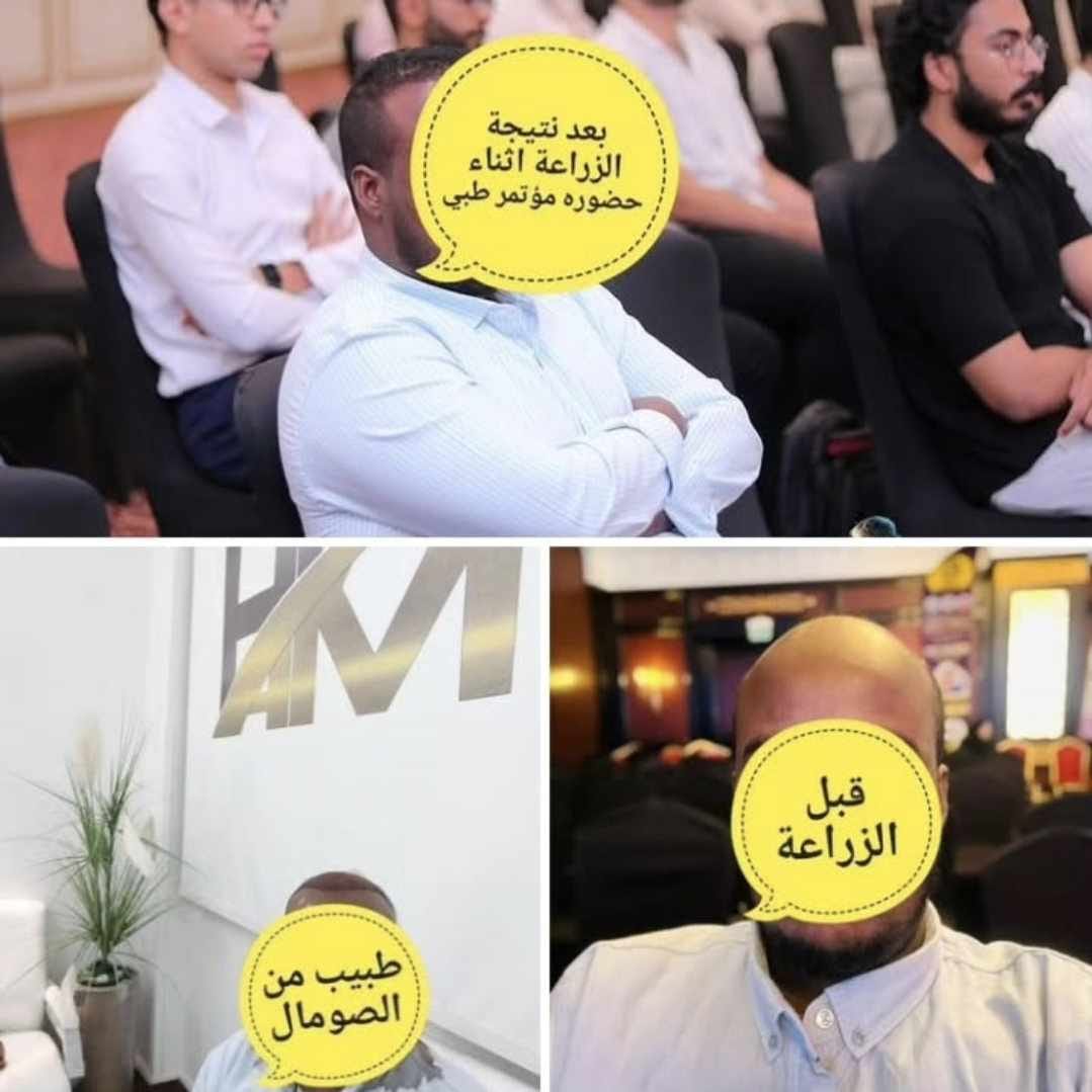 بعد 2