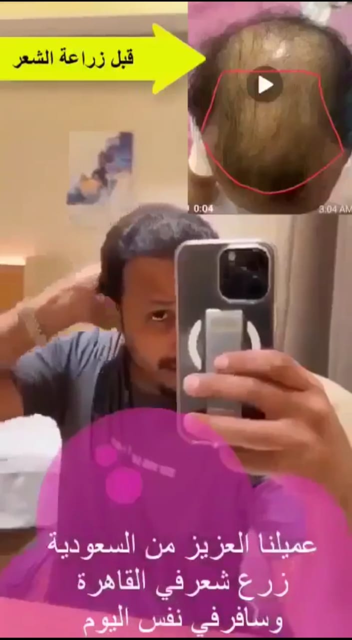 رأي عميل